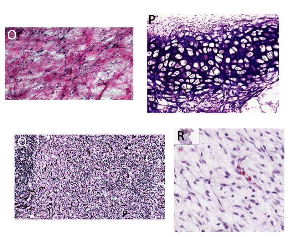 Solved Please Identify The Connective Tissues In The Images Chegg