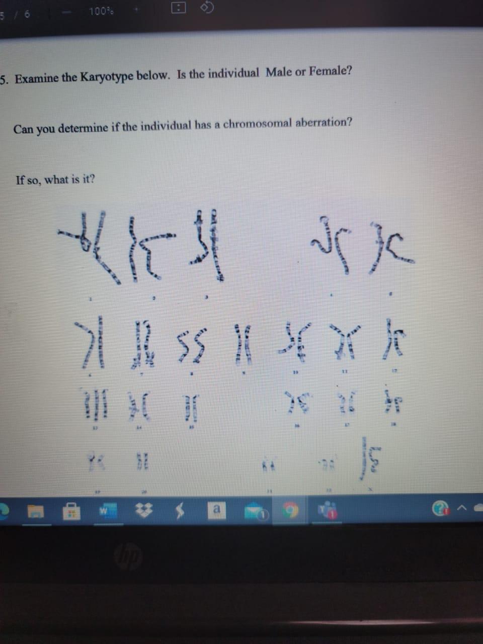 Solved Examine The Karyotype Below Is The Chegg