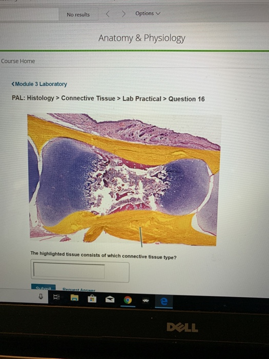 Solved Options V No Results Anatomy Physiology Course Chegg