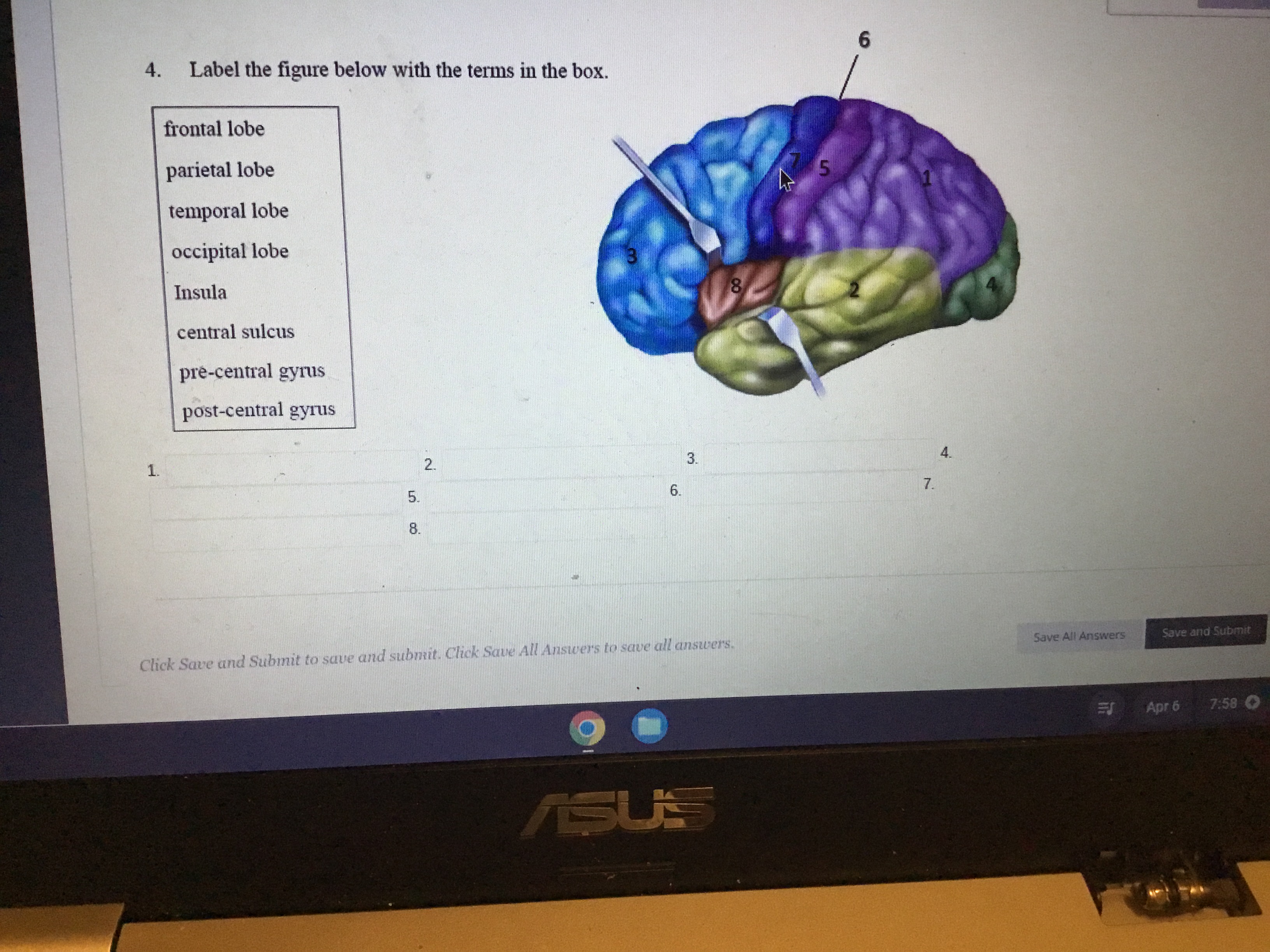 Solved Label The Figure Below With The Terms In The Chegg