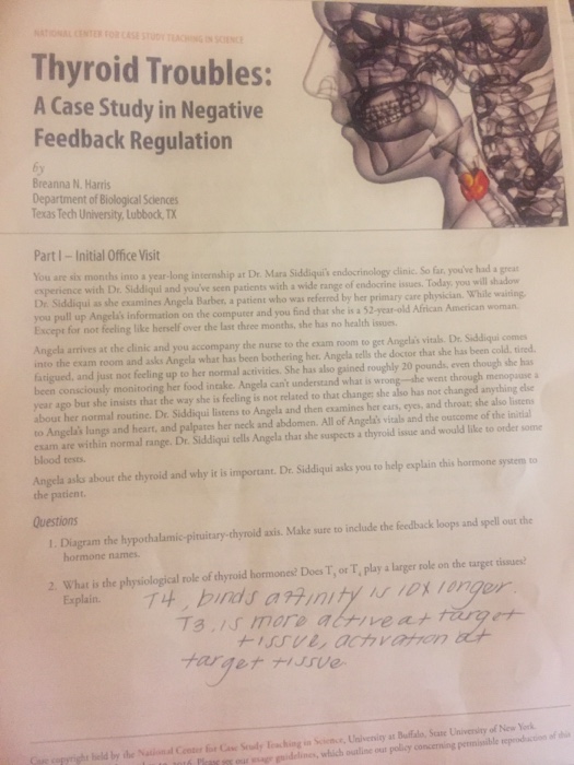 Hyperthyroidism case study questions picture