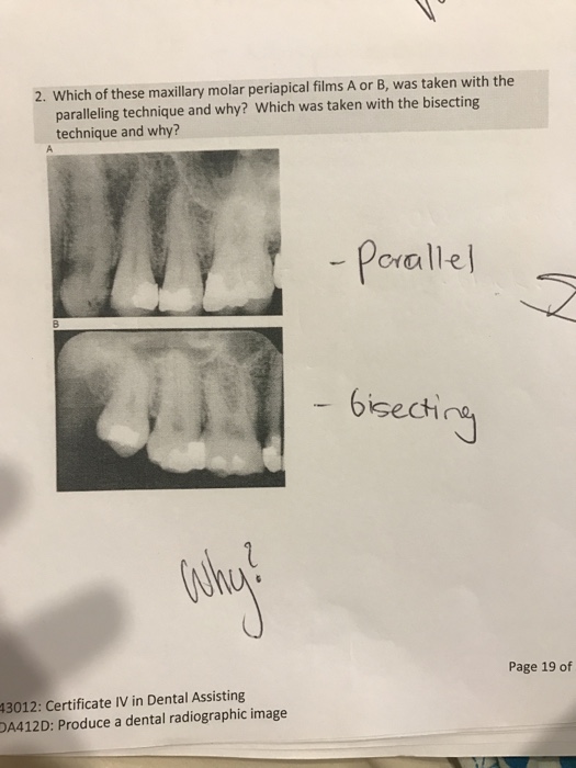 Solved Which Of These Maxillary Molar Periapical Films A