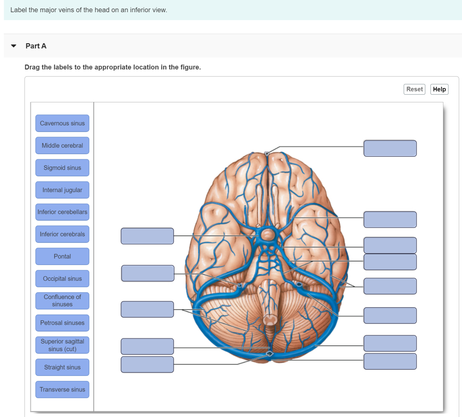 Solved Label The Major Veins Of The Head On An Inferior Chegg