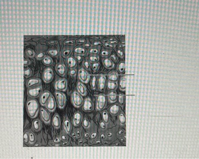 Solved Identify Types Of Connective Tissuelabel The Follo