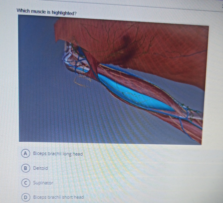 Solved Which Muscle Is Highlighted Biceps Brachil Long Chegg