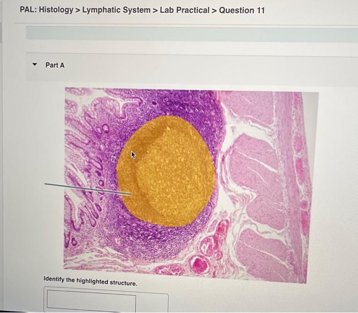 Solved PAL Histology Lymphatic System Lab Practical Chegg