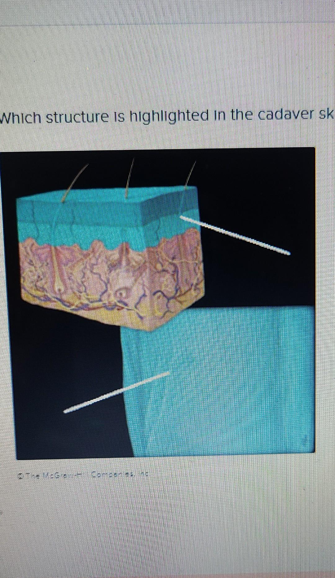 Solved Q1 With Picture 1 Which Structure Is Highlighted In Chegg