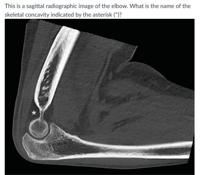 Solved This Is A Sagittal Radiographic Image Of The Elbo