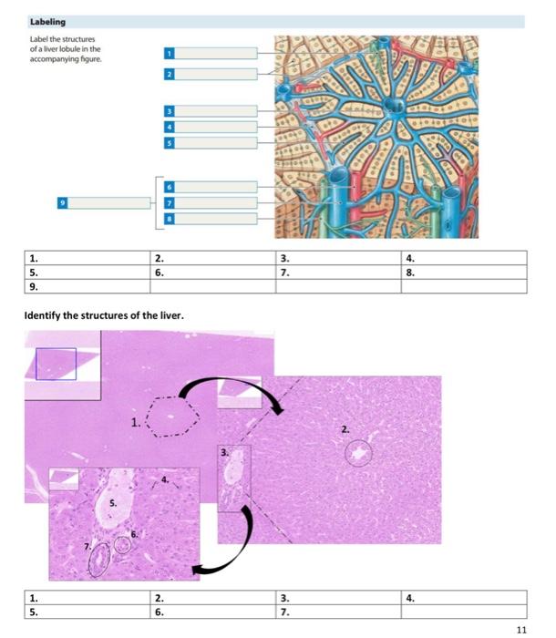 Solved Identify The Structures Of The Liver Chegg