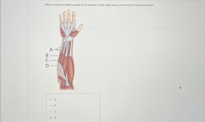 Solved Which Muscle Is An Antagonist To The Biceps Brachil Chegg