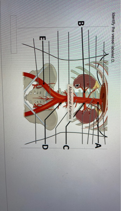 Solved Identify The Vessel Labeled D A B Abdominal Chegg