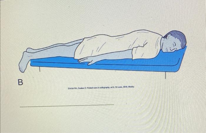 Solved Identify And Label The Radiographic Positions Below Chegg