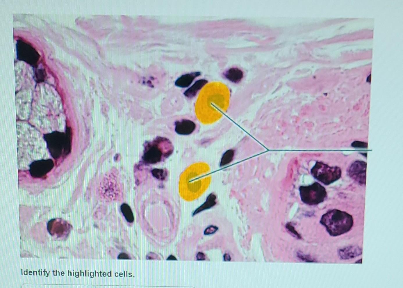 Solved Pal Histology Connective Tissue Lab Practical Chegg