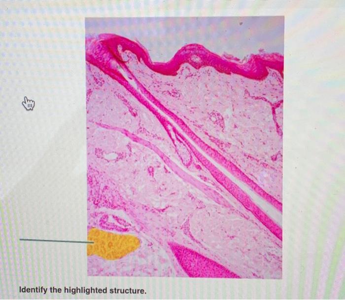 Solved Identify The Highlighted Structure Identify The Chegg