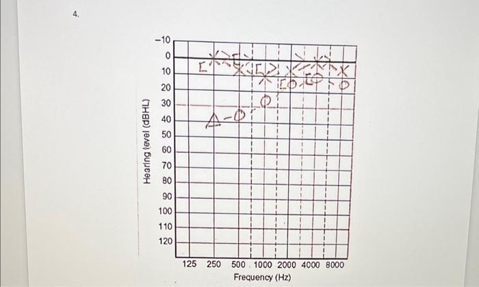 Solved Audiogram Interpretation Assignment Instructions Chegg