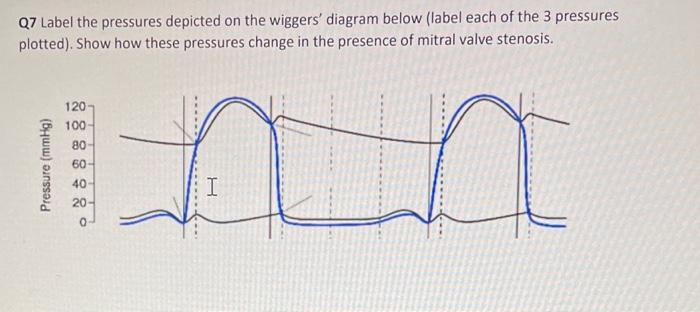 Solved Q Label The Pressures Depicted On The Wiggers Chegg