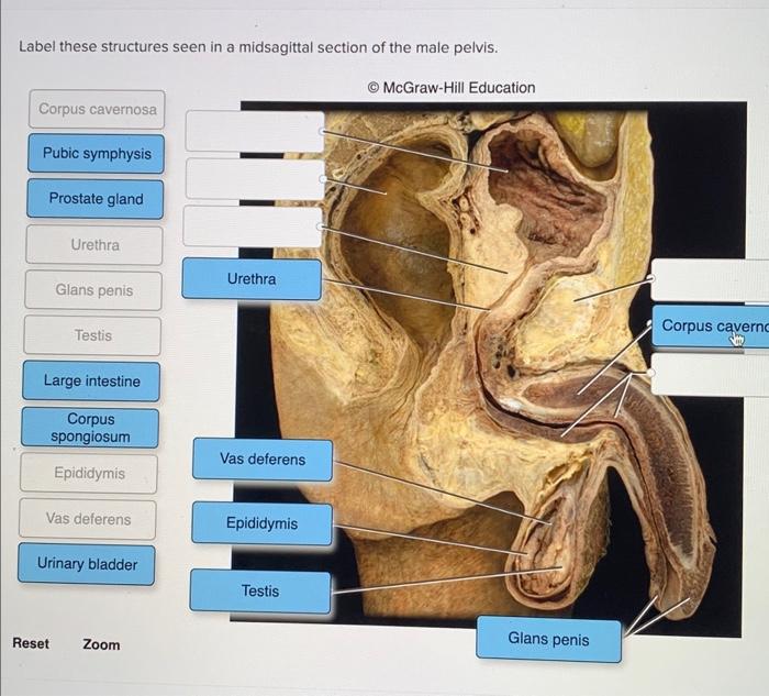 Solved Label These Structures Seen In A Midsagittal Section Chegg