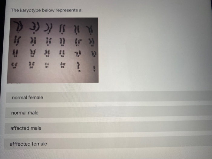 Solved The Karyotype Below Represents A 17 3 IS Normal Chegg