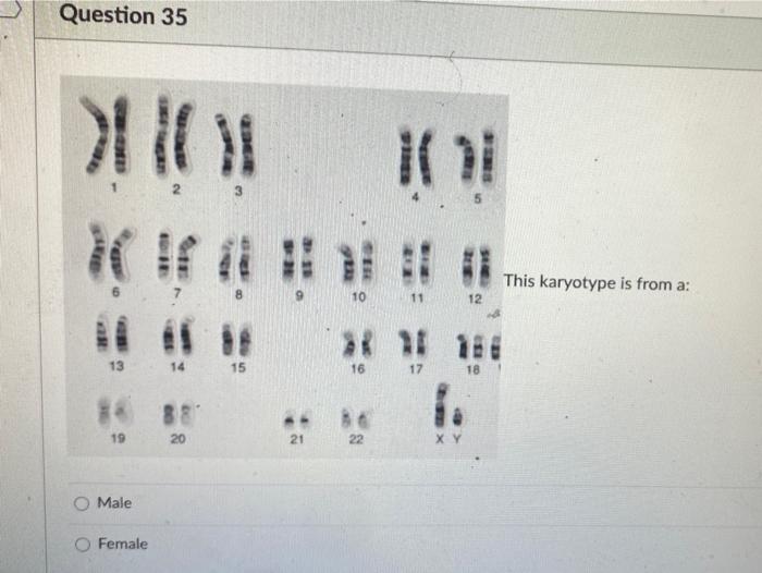 Solved Question 35 This Karyotype Is From A 9 10 11 12 13 Chegg