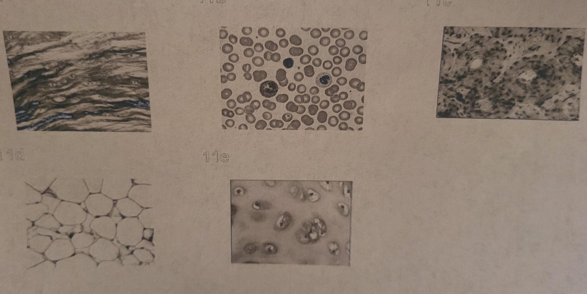 Solved Identify The Connective Tissues In The Pictures Chegg