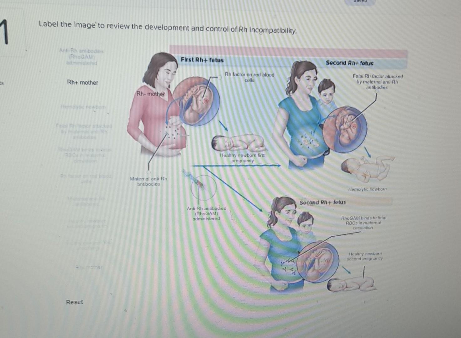 Solved Label The Image To Review The Development And Control Chegg