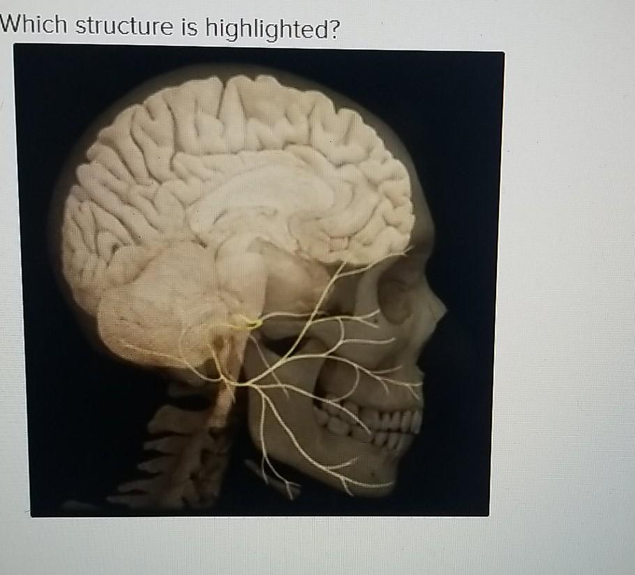 Solved Which Structure Is Highlighted Multiple Choice Chegg