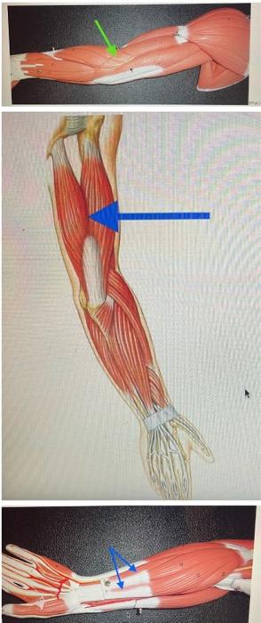 Solved Identify The Muscles Chegg