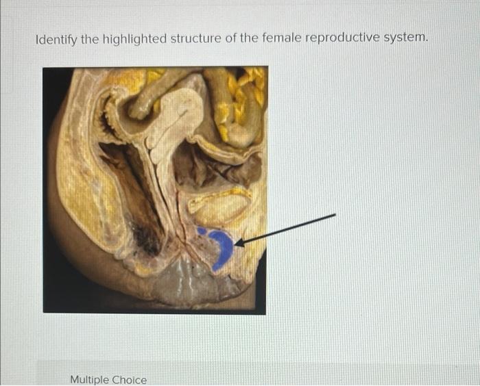 Solved Identify The Highlighted Structure Of The Female Chegg