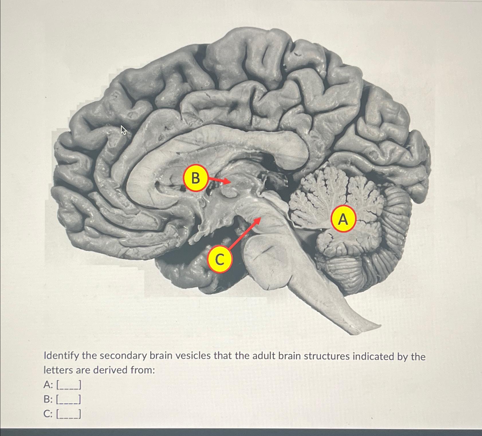 Solved Identify The Secondary Brain Vesicles That The Adult Chegg