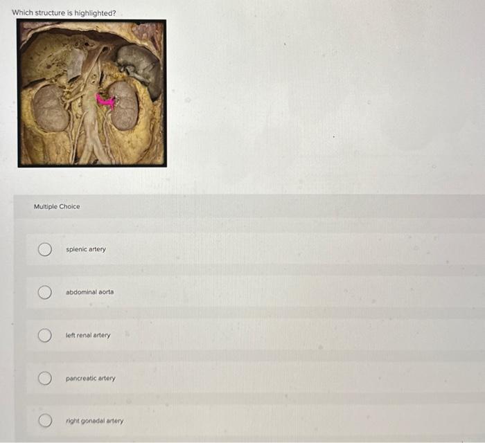 Solved Which Structure Is Highlighted Multiple Choice S