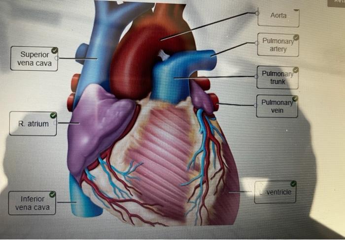 Solved Label The Structures Seen In An Anterior View Of The Chegg