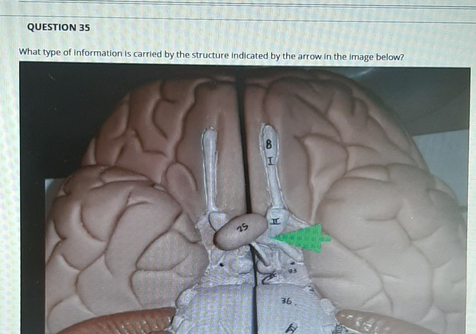 Solved Identify The Structure Indicated By The Arrow In The Chegg