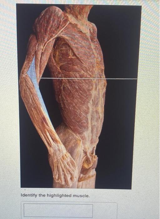 Solved Part A Identify The Action Of The Highlighted Muscle Chegg