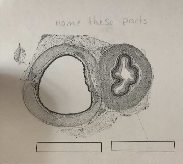 Solved Name These Parts Chegg