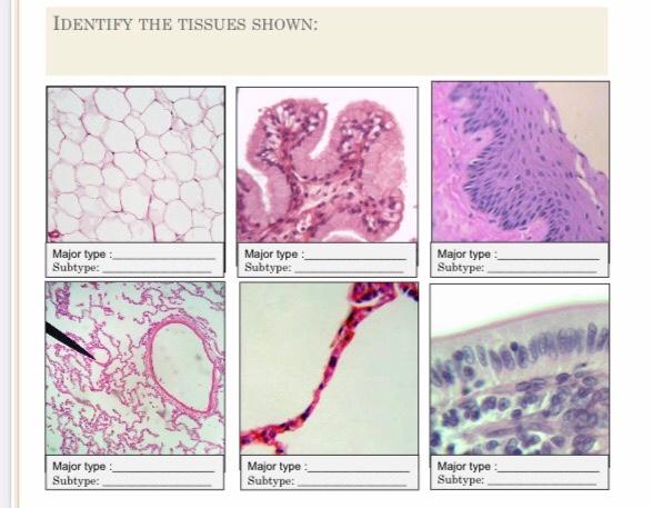 Solved Identify The Tissues Shown Major Type Subtype Chegg