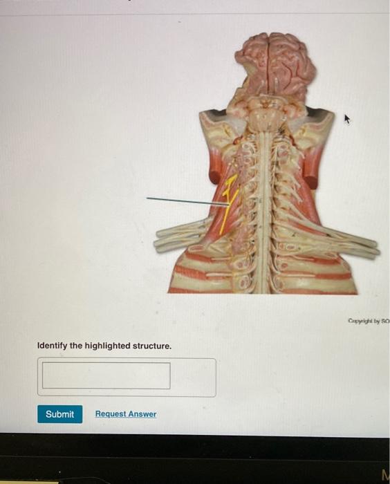 Solved City 80 Identify The Highlighted Structure Submit Chegg