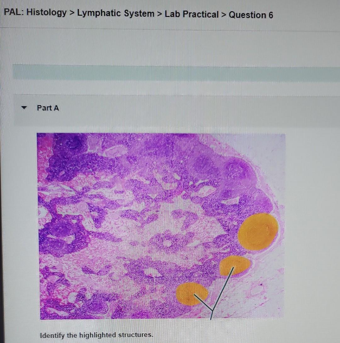 Solved PAL Histology Lymphatic System Lab Practical Chegg