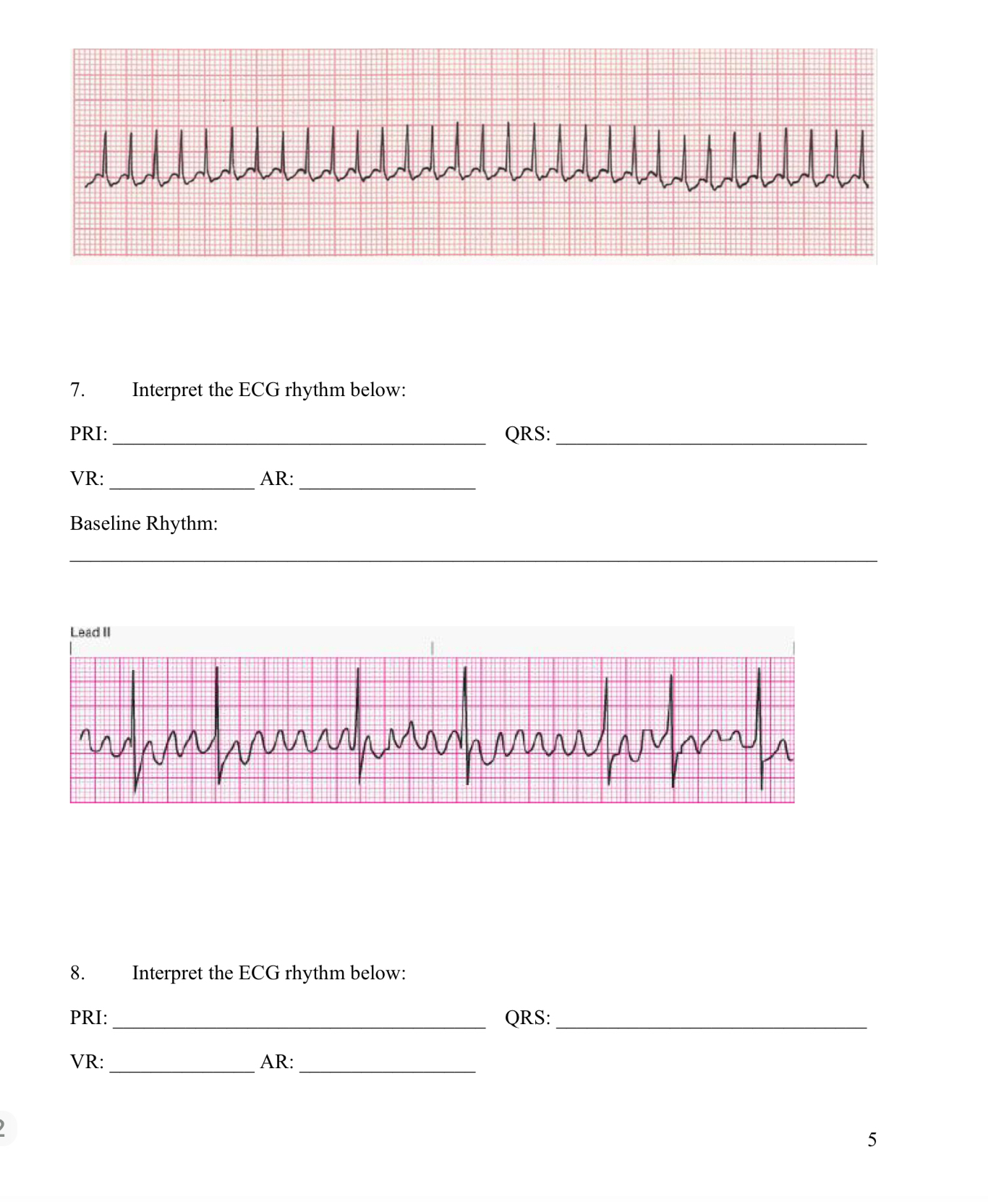 Solved Interpret The Ecg Rhythm Below Pri Qrs Ventricular Chegg