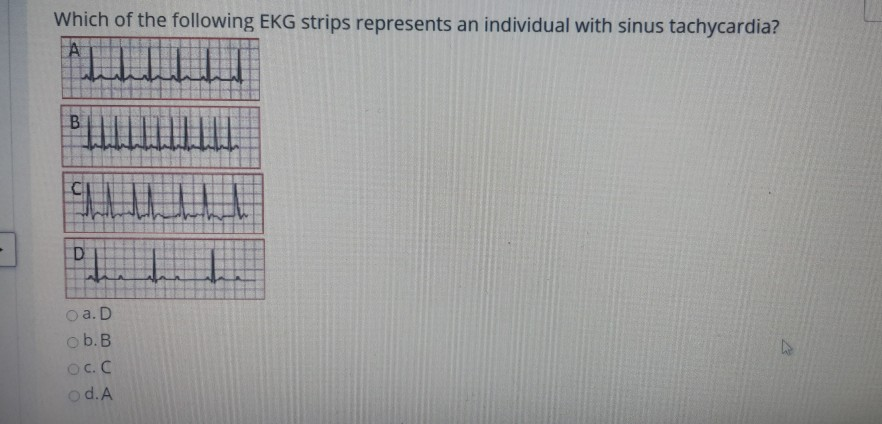 Solved Which Of The Following EKG Strips Represents An Chegg