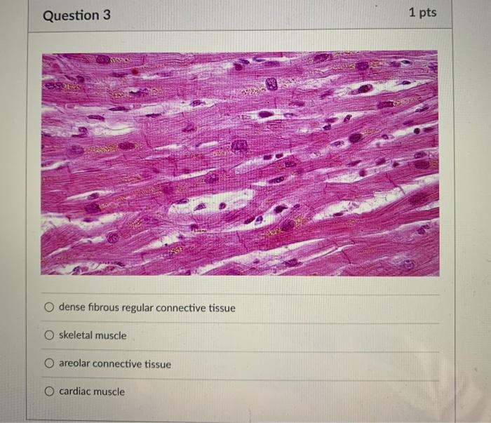 Solved Question O Hyaline Cartilage Connective Tissue Chegg