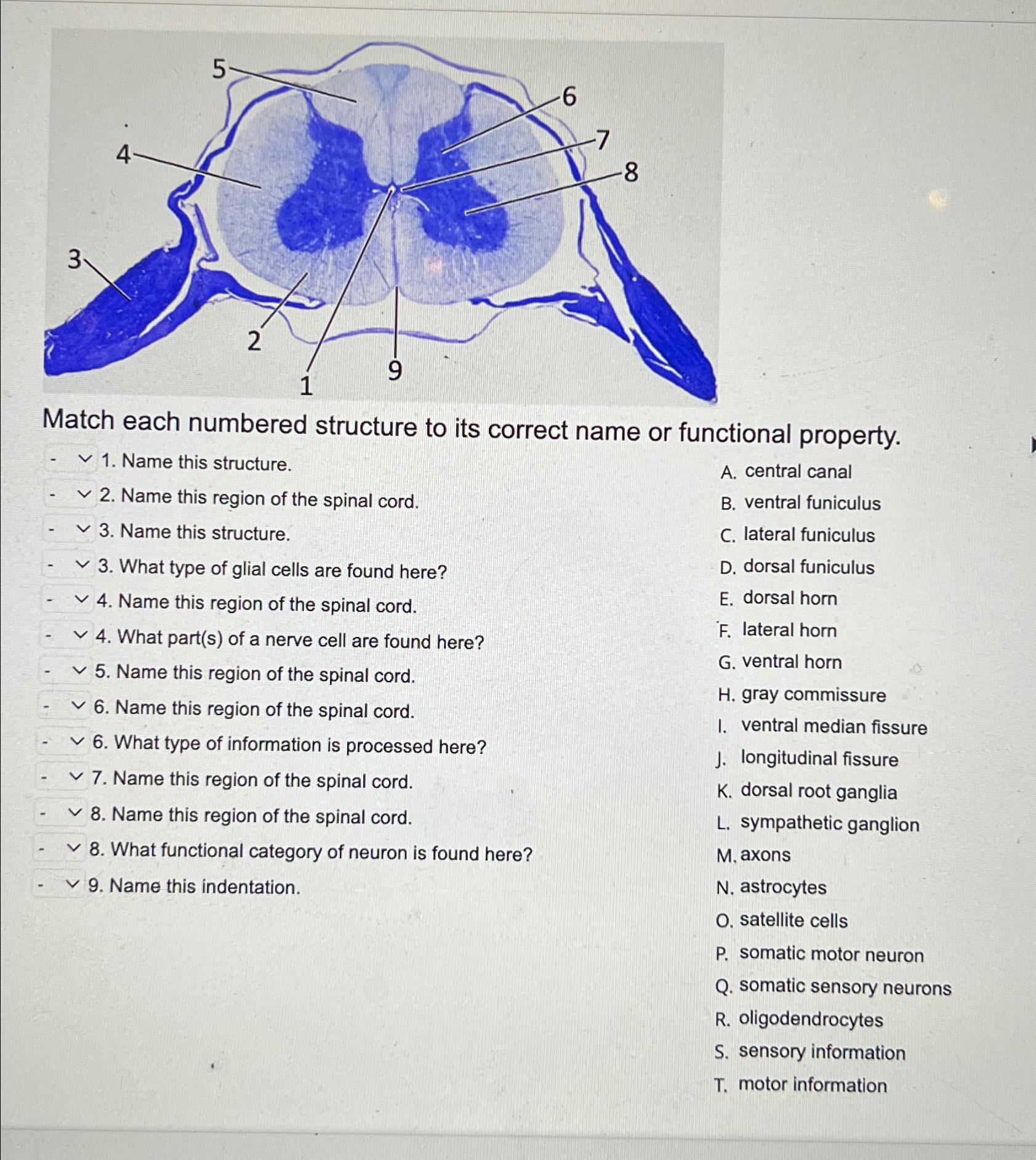 Solved Match Each Numbered Structure To Its Correct Name Or Chegg