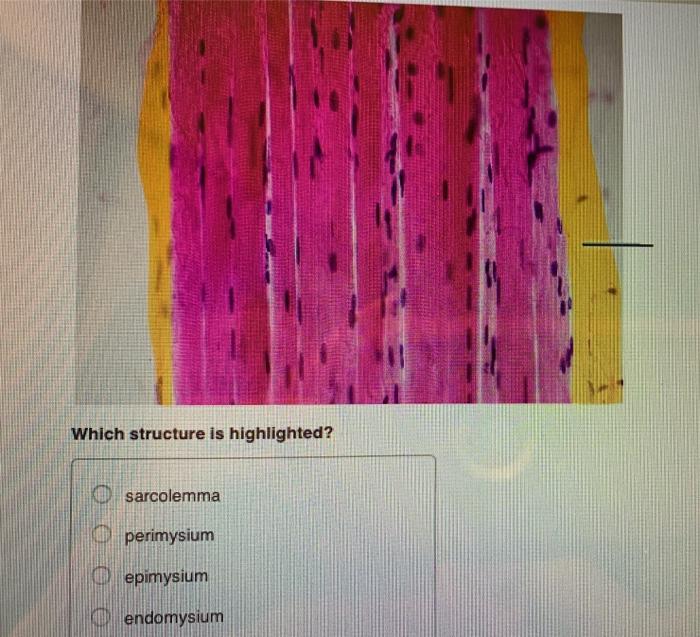 Solved Which Structure Is Highlighted O Sarcolemma Chegg