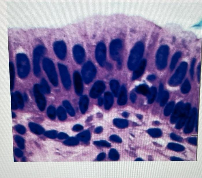 Solved Identify The Complete Name Of Each Exhibited Tissues Chegg