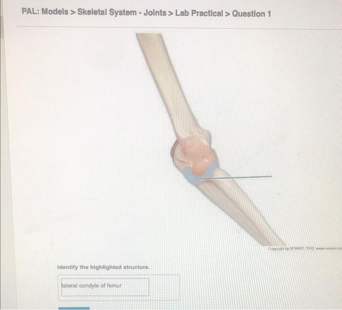 Solved PAL Models Skeletal System Joints Lab Chegg