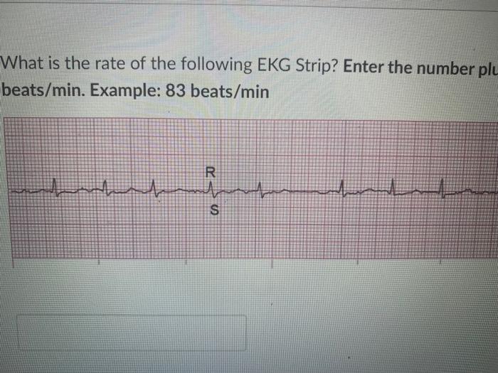 Solved What Is The Rate Of The Following EKG Strip Enter Chegg