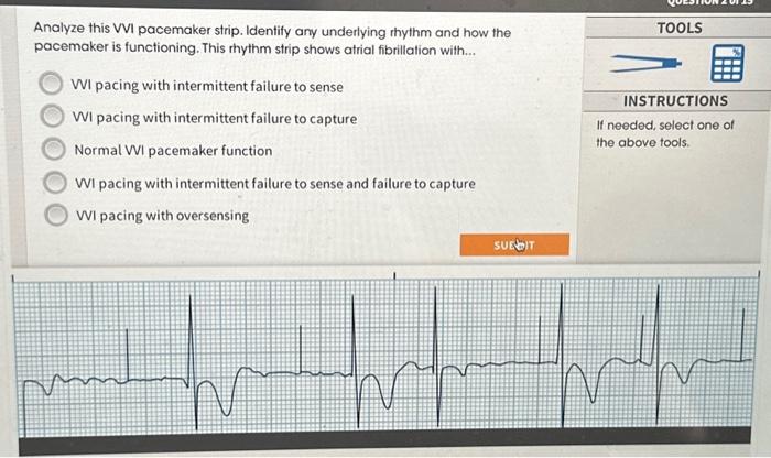 Solved Analyze This Vvi Pacemaker Strip Identify Any Chegg