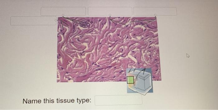 Correctly Identify This Tissue Type Practice