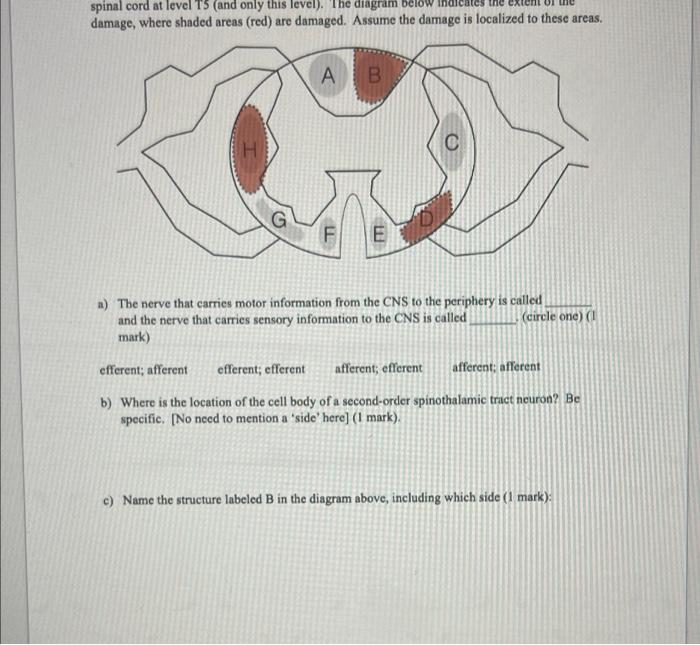 Solved Onung Spinal Cord At Level T And Only This Level Chegg