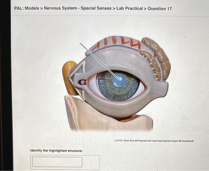 Solved Pal Histology Special Senses Lab Practical Chegg Hot Sex Picture