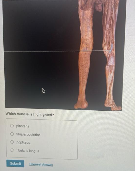 Solved The Highlighted Muscle Acts On Which Structure Of The Chegg